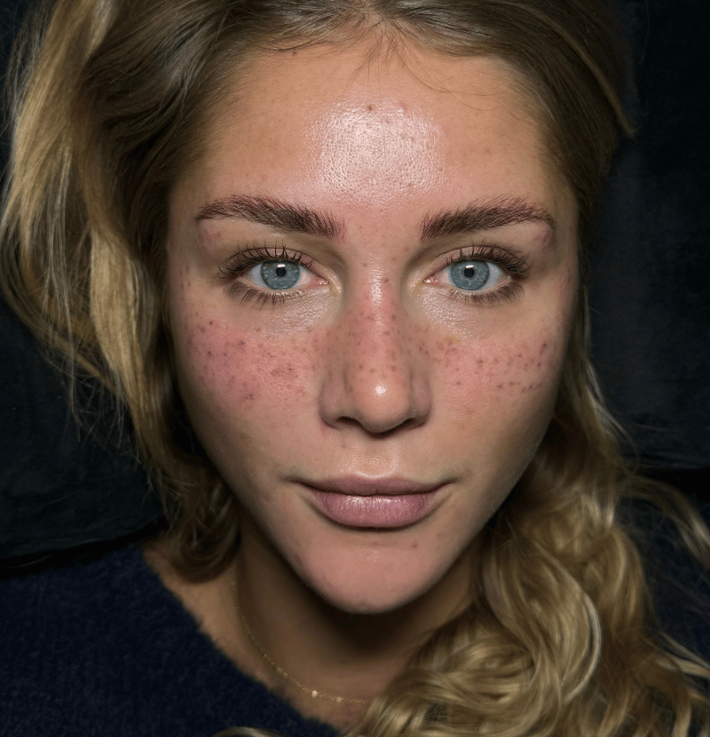 pmu permanent make up berlin foto modell ergebnis freckles